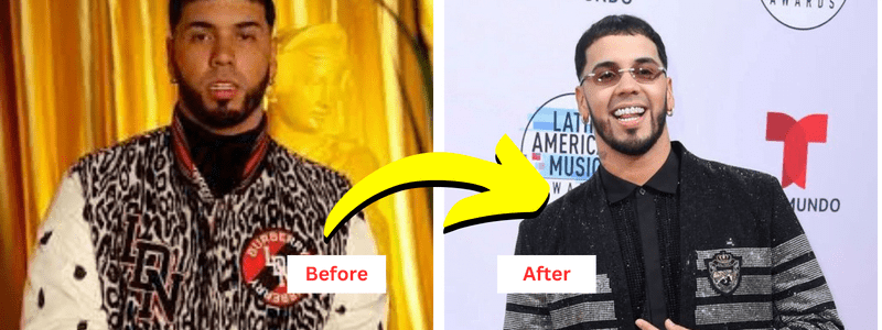 Anuel AA Weight Loss Journey That You Can Follow