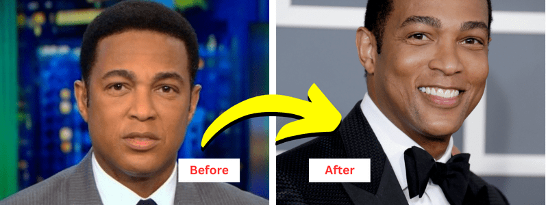 Don Lemon Weight Loss: The Real Story of Success.