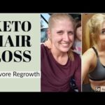 Keto Diet And Hair Loss: Causes, Prevention & Expert Tips