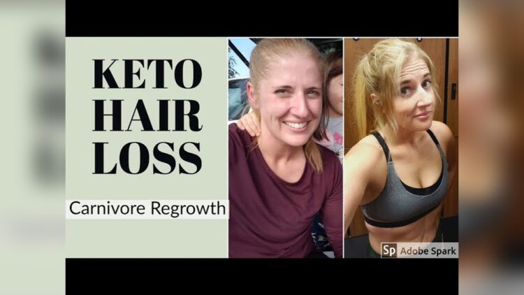 Keto Diet And Hair Loss